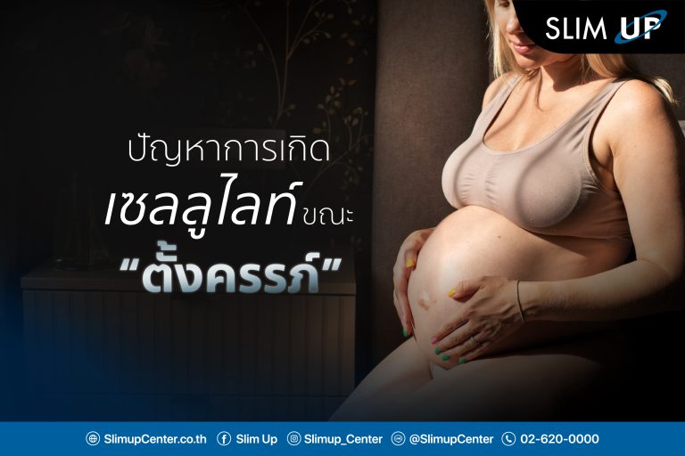 ปัญหาการเกิด เซลลูไลท์ !! ขณะ ” ตั้งครรภ์ “