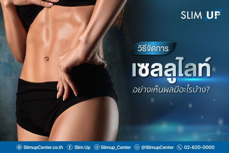 วิธีการจัดการ ” เซลลูไลท์ ” อย่างเห็นผลมีอะไรบ้าง ⁉️