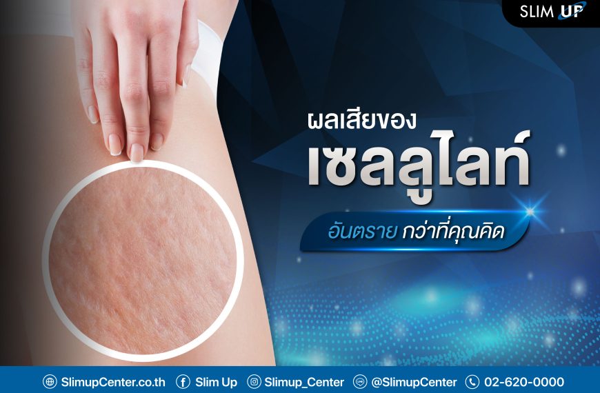 ผลเสียของ เซลลูไลท์ ” อันตราย ” กว่าที่คุณคิด !?