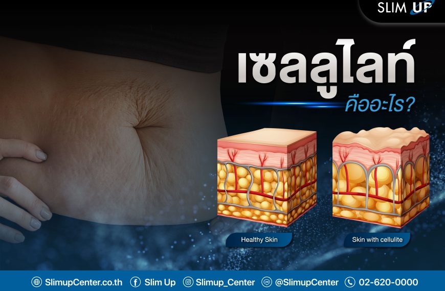 ” เซลลูไลท์ ” คืออะไร ?