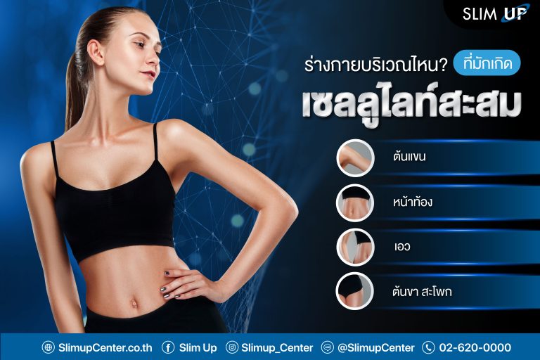 ” ร่างกาย ” บริเวณไหน? ที่มักเกิด เซลลูไลท์สะสม ‼️