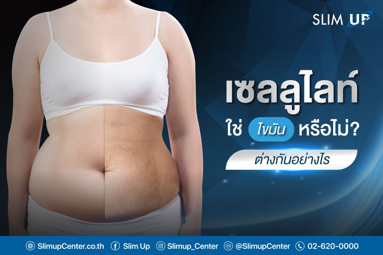 เซลลูไลท์  ใช่ ” ไขมัน ” หรือไม่? ต่างกันอย่างไร
